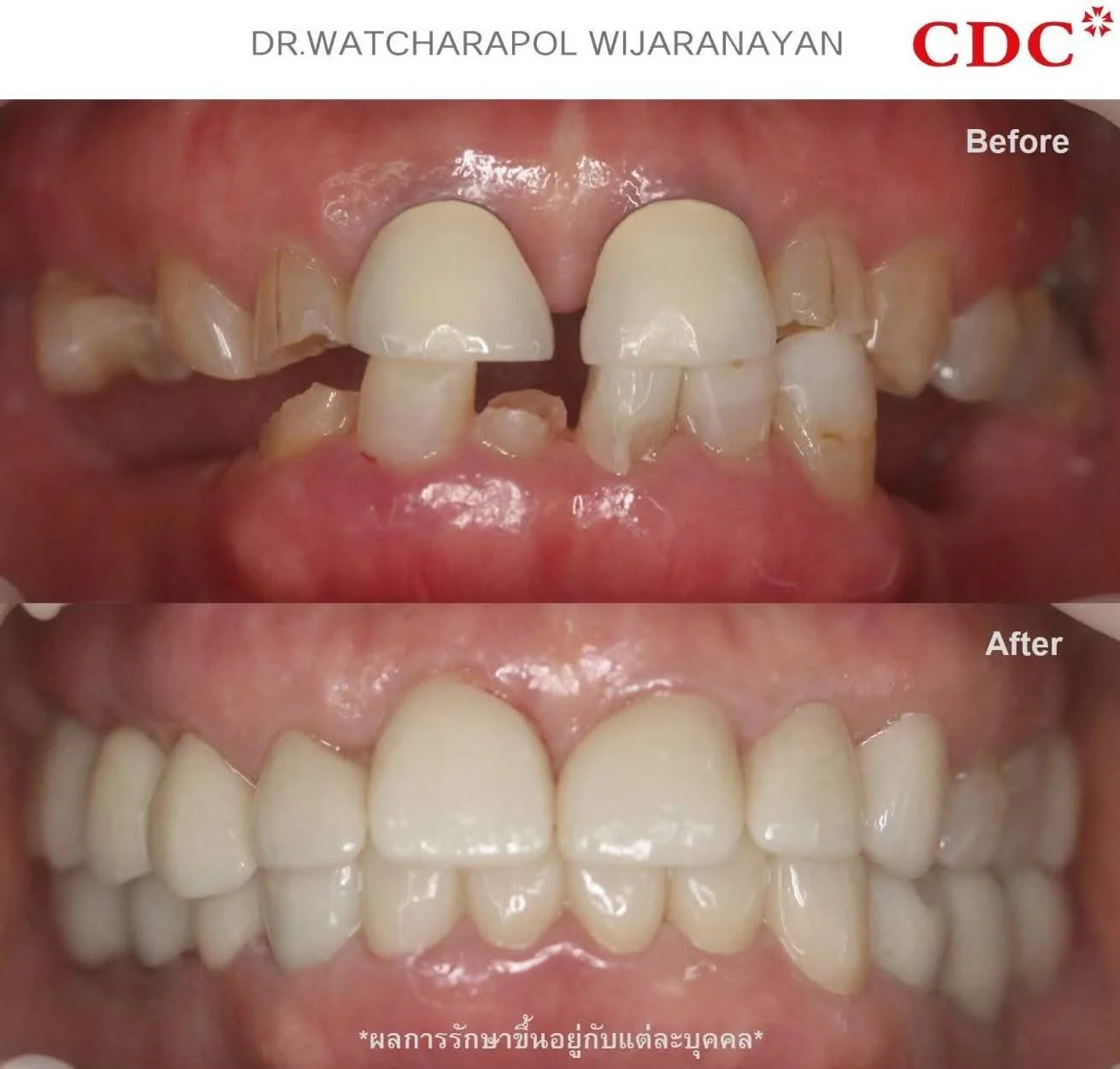 professional dental clinic interior with modern implant equipment and smiling patient consultation